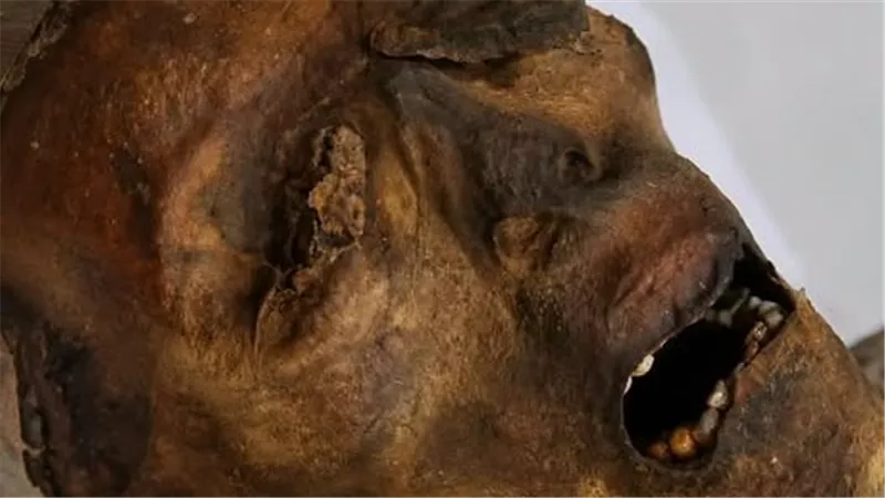 مومياء الرجل الصارخ  